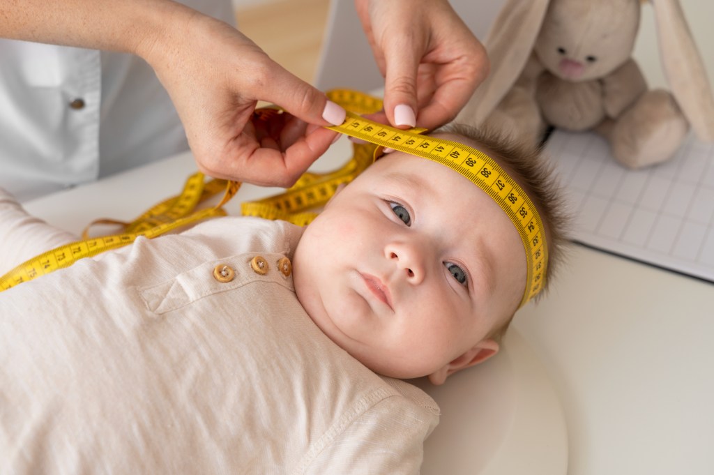 Hidrocefalia – O que é&nbsp;isso?